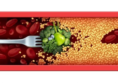 cholesterol
