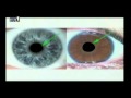 Iridology_4.jpg