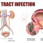 UTIs