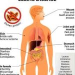 celiac disease and health