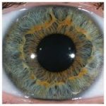 Iridology
