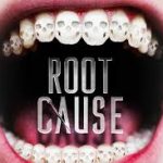 root canals and health
