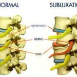 osteopathy