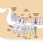 teeth and health