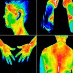 thermography