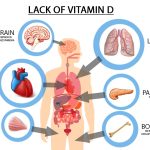 vitamin D and health
