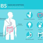 Irritable Bowel Syndrome