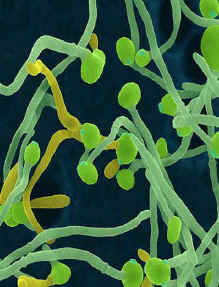 The mycelial, pathogenic form of Candida under the microscope