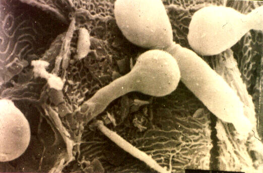 Candida penetrating human kidney tissue under the microscope