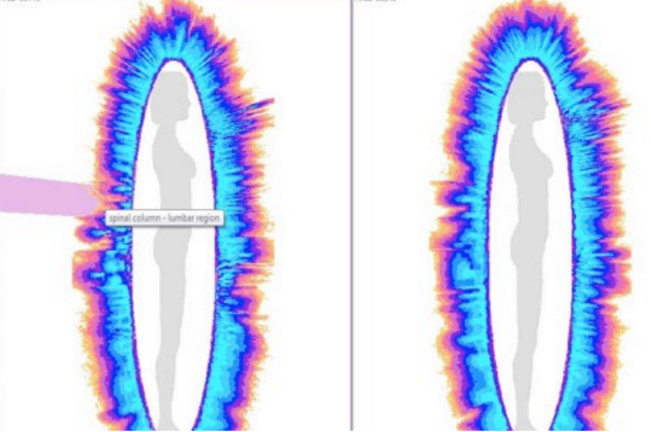 Energy field images around the human contour, from the Bio-Well software