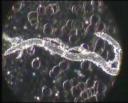 Live blood under the dark-field microscope