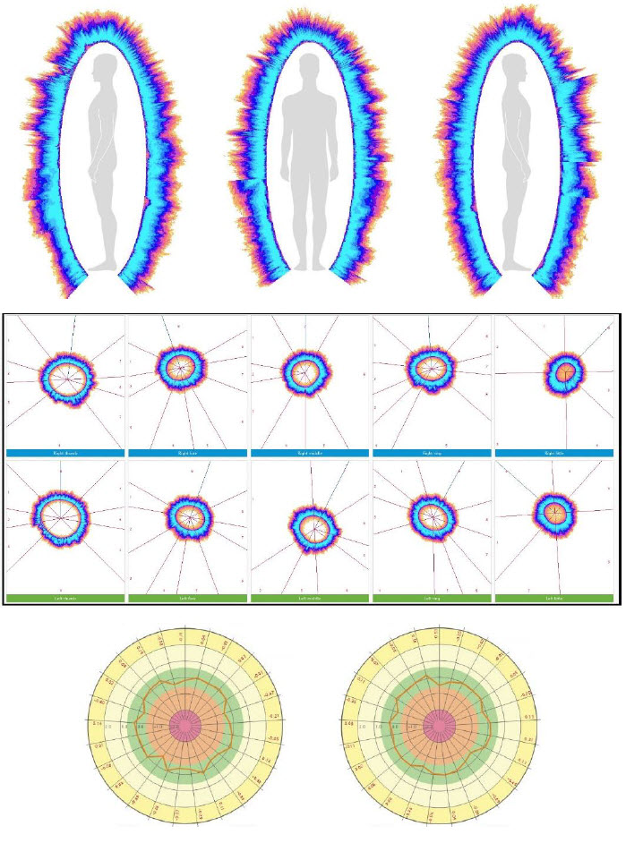 An energy field report: the field around the body, the ten fingertip images and diagrams