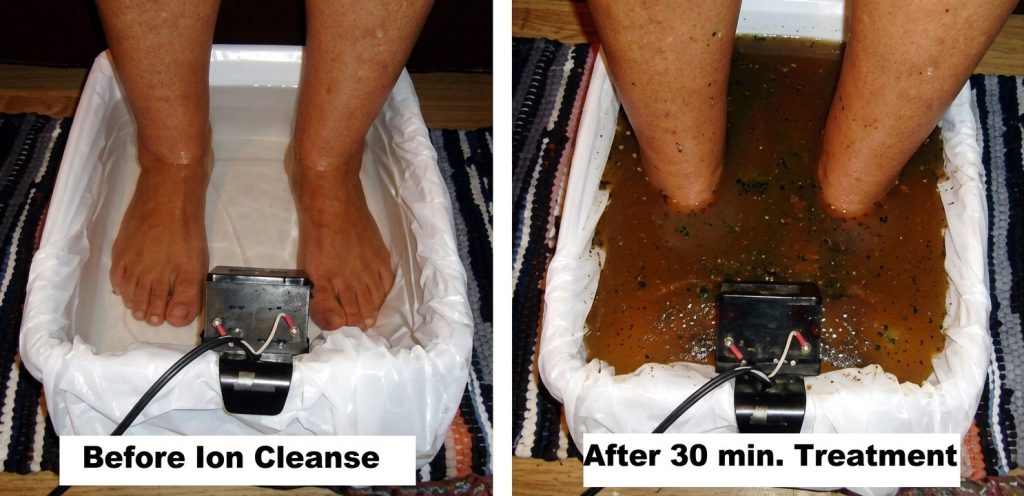 Footbath water before an ion cleanse and after a 30-minute treatment