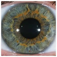 Close view of an iris, showing pigment and structure