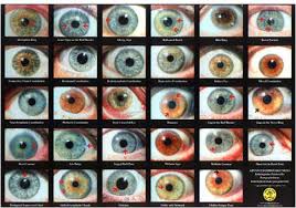 Iris constitutions