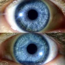 A pair of irides