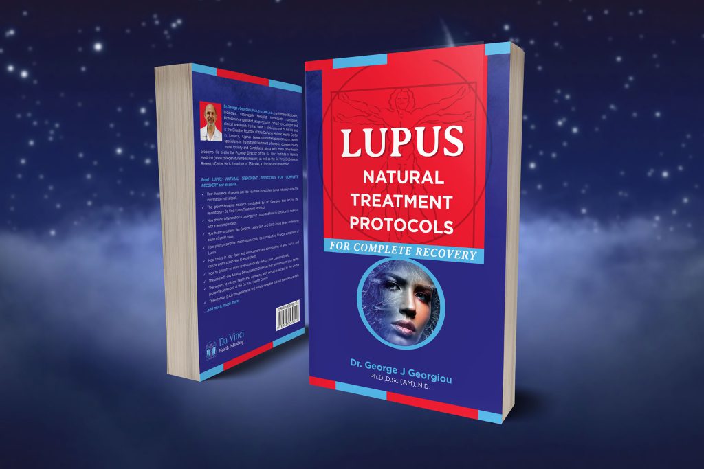 Cover of Lupus: Natural Treatment Protocols for Complete Recovery