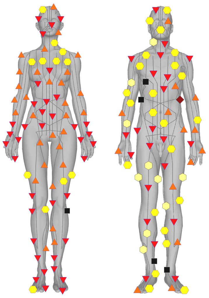 Metatron scan results: coloured marks on 3D models of the body